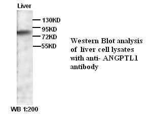 Anti-ANGPTL1