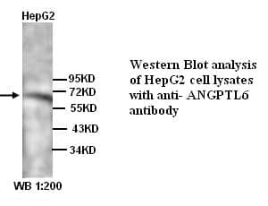 Anti-ANGPTL6