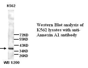 Anti-Annexin A1