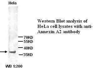 Anti-Annexin A2