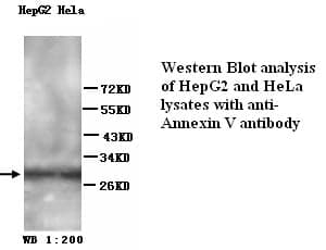 Anti-Annexin V