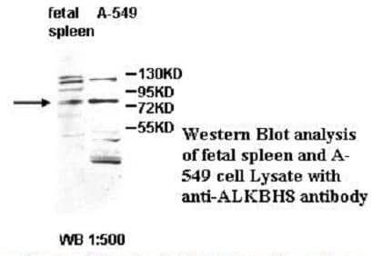 Anti-ALKBH8