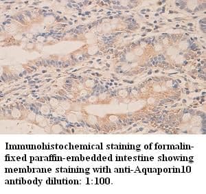 Anti-Aquaporin10