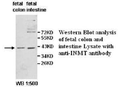 Anti-INMT