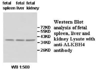 Anti-ALKBH4