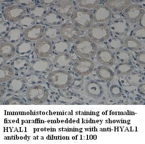 Anti-HYAL1
