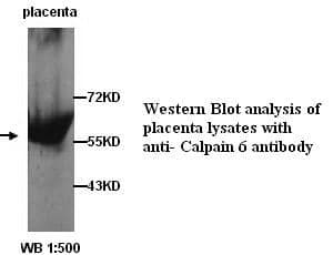 Anti-Calpain 6