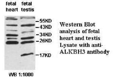 Anti-ALKBH3