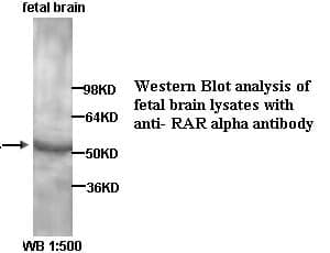 Anti-RAR alpha