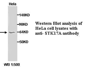 Anti-STK17A