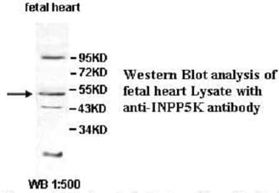 Anti-INPP5K