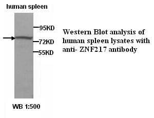 Anti-ZNF217