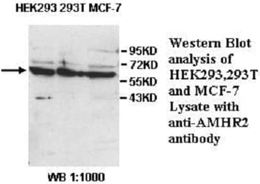 Anti-AMHR2