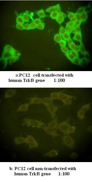 Anti-TrkB