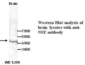Anti-NSE