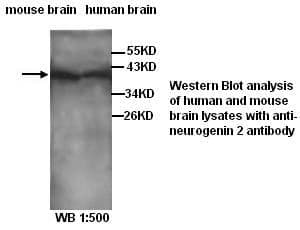 Anti-neurogenin 2