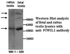 Anti-PIWIL1