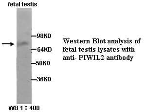 Anti-PIWIL2