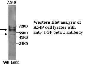 Anti-TGF&beta;1