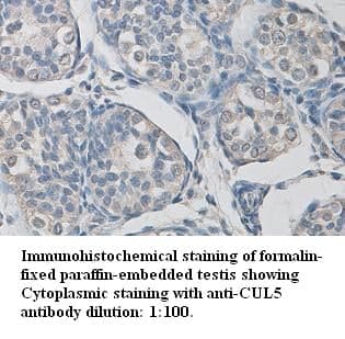 Anti-CUL5