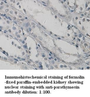 Anti-parathymosin