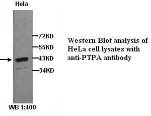 Anti-PTPA