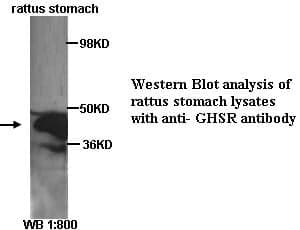 Anti-GHSR