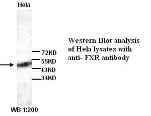 Anti-FXR