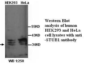 Anti-STUB1