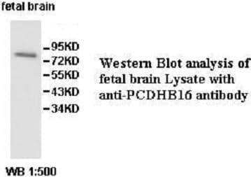 Anti-PCDHB16