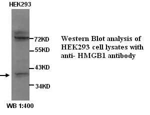 Anti-HMGB1