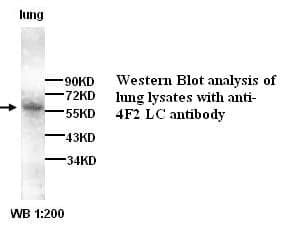 Anti-4F2LC