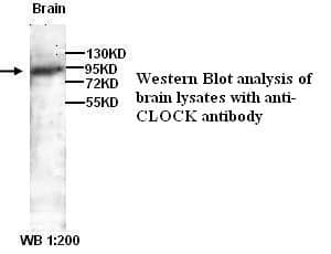 Anti-CLOCK )