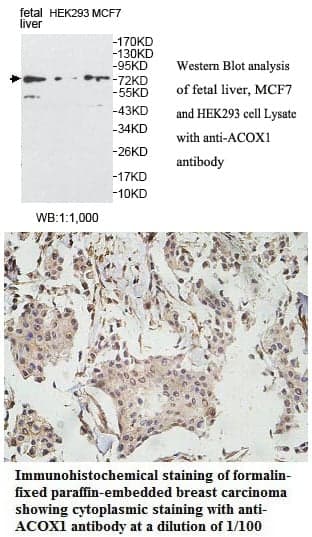 Anti-ACOX1