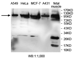 Anti-ACTN4