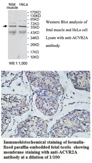 Anti-ACVR2A