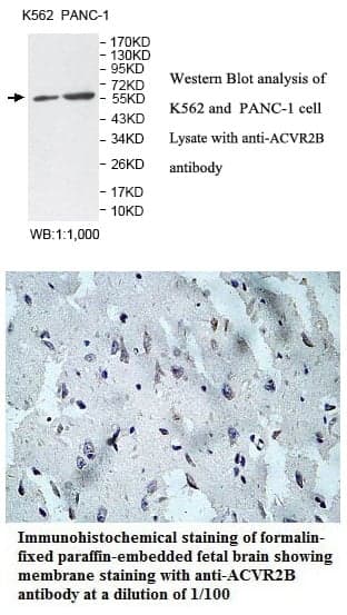 Anti-ACVR2B