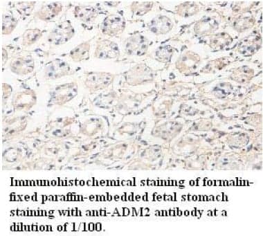 Anti-ADM2