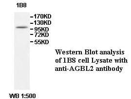 Anti-AGBL2