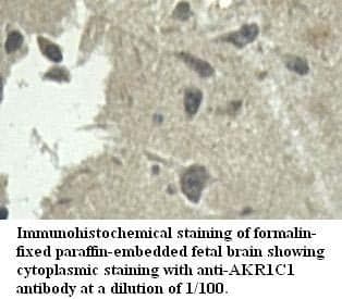 Anti-AKR1C1