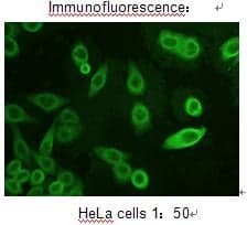 Anti-AKR1C3