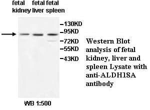 Anti-ALDH18A