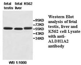 Anti-ALDH1A2
