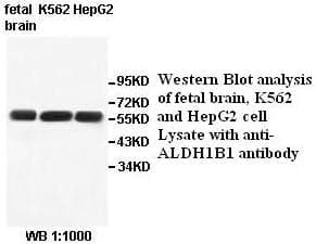 Anti-ALDH1B1