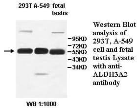 Anti-ALDH3A2