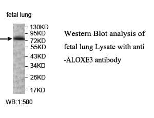 Anti-ALOXE3