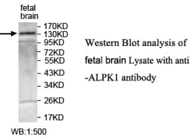 Anti-ALPK1