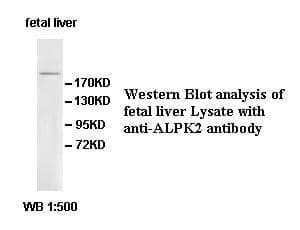 Anti-ALPK2