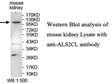 Anti-ALS2CL