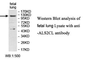 Anti-ALS2CL